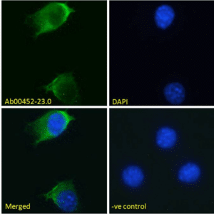 EGFR Recombinant Antibody [S3 12D]