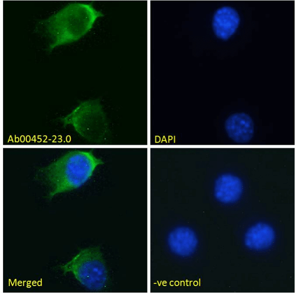 EGFR Recombinant Antibody [S3 12D]
